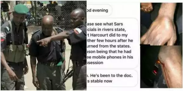 For being in possession of 3 phones, SARS operatives assault U.S returnee